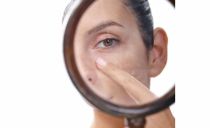Những lầm tưởng về nguyên nhân gây nám da chị em nên biết